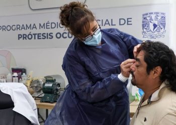 Programa de Protesis ocular en Quintana Roo Una oportunidad para mejorar la calidad de vida