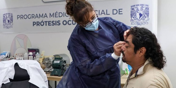 Programa de Protesis ocular en Quintana Roo Una oportunidad para mejorar la calidad de vida