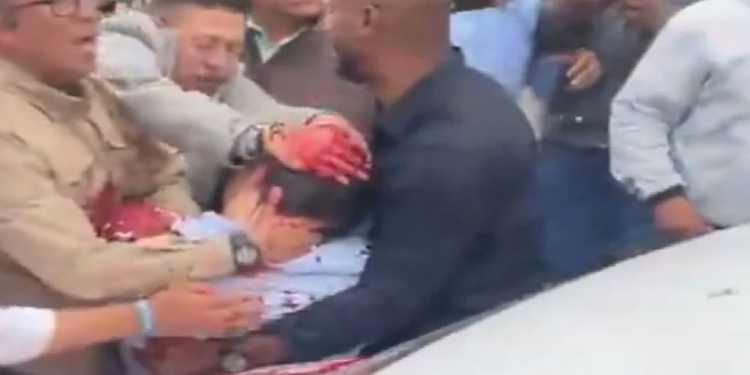 Policía custodia la escena del atentado al senador Miguel Uribe Turbay en Bogotá, junio 2025