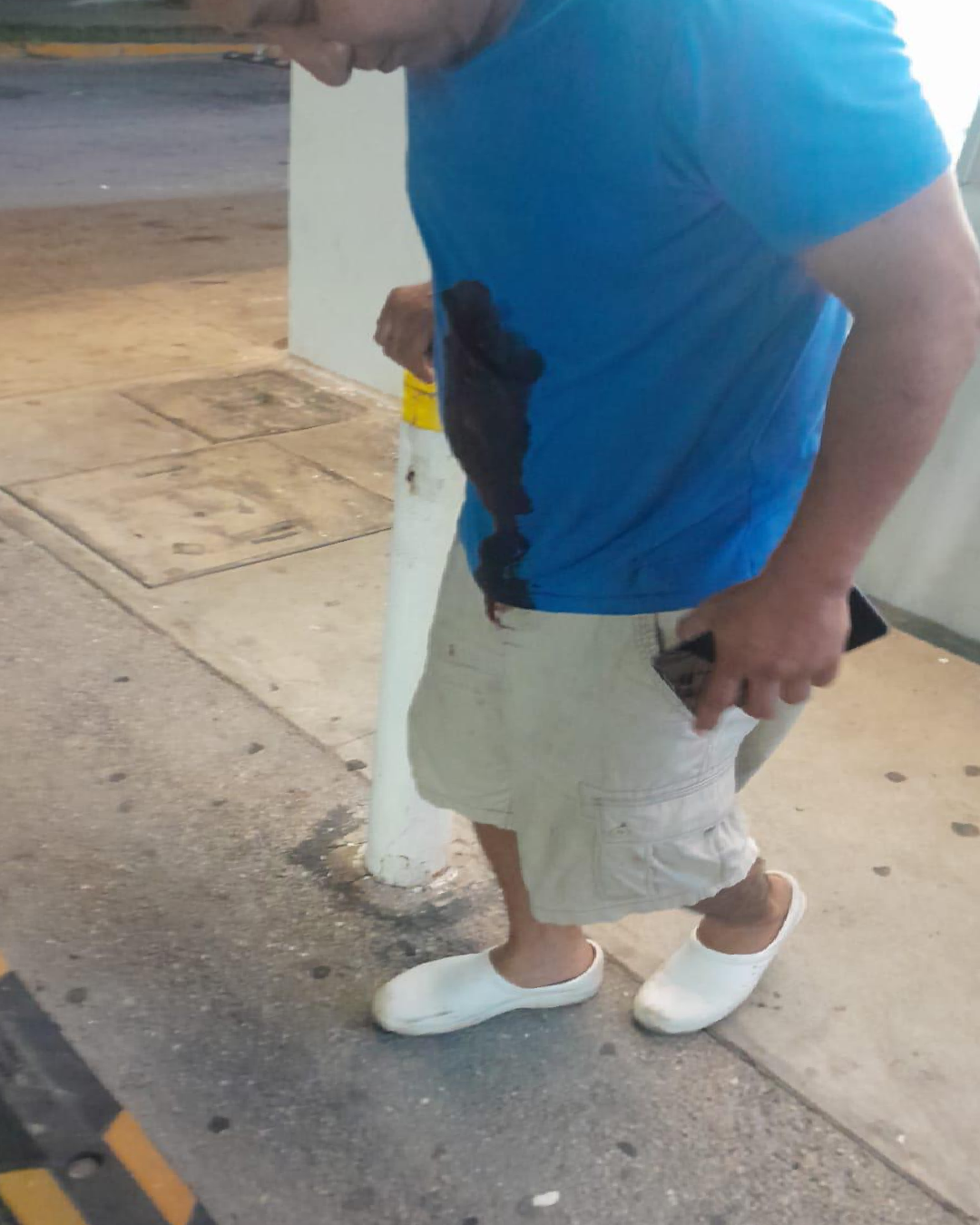 Herida punzocortante en abdomen de la víctima
