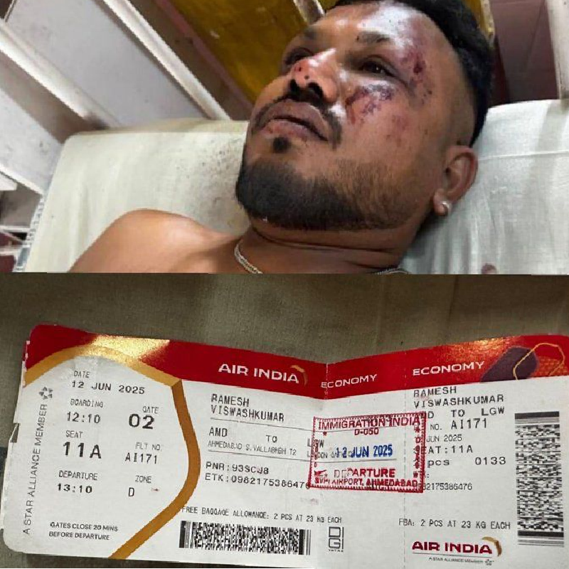 Viswash Kumar Ramesh, único sobreviviente del accidente aéreo en India
