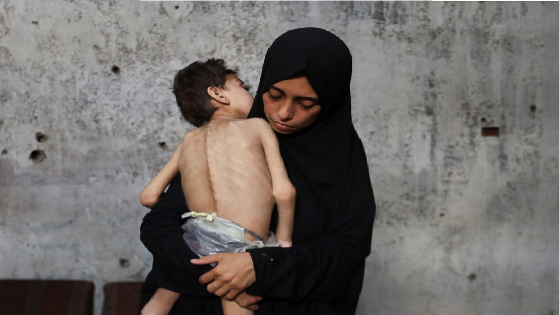 Madres palestinas con niños afectados por la falta de alimentos en Gaza