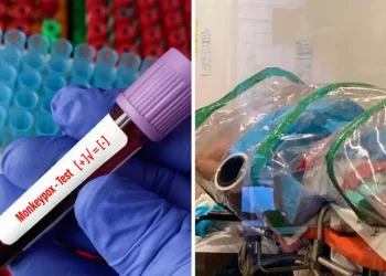 Mpox en Quintana Roo: Cómo se contagia y qué hacer si presentas síntomas