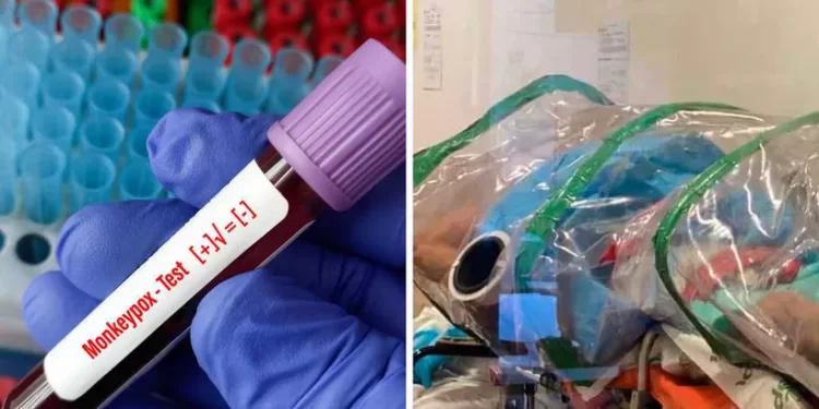 Mpox en Quintana Roo: Cómo se contagia y qué hacer si presentas síntomas