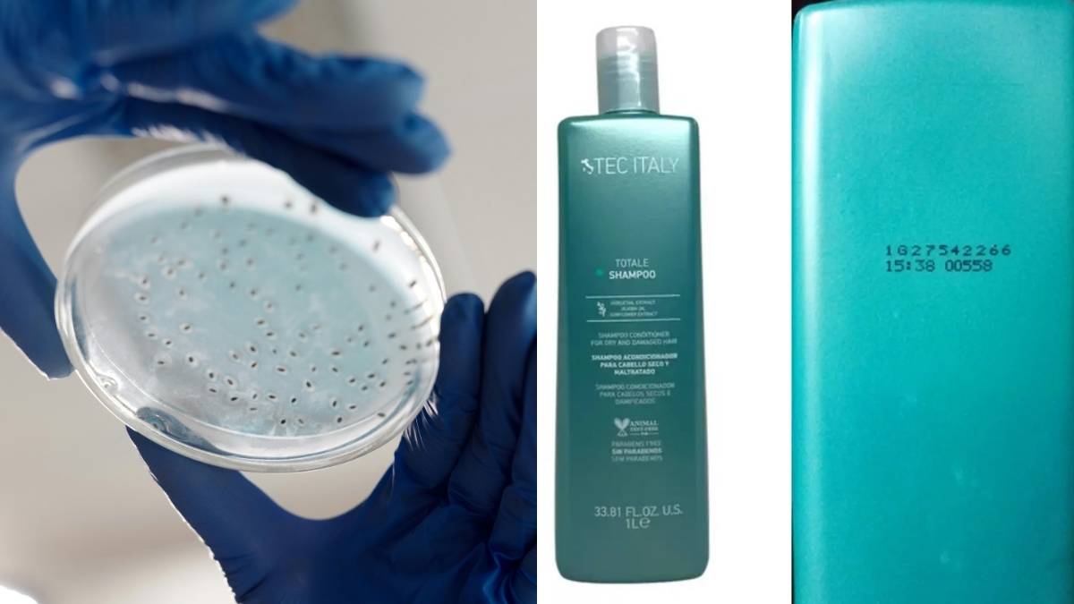 Que shampoo fue retirado del mercado