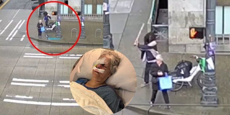 Indigente arranca el ojo a adulta mayor durante brutal ataque en Seattle