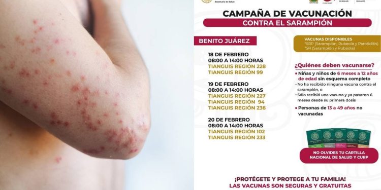 Campaña de Vacunacion contra el Sarampion en Quintana Roo sede fechas y requisitos