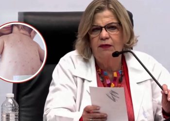 Confirman primera muerte por sarampion en CDMX suman 28 fallecimientos en Mexico