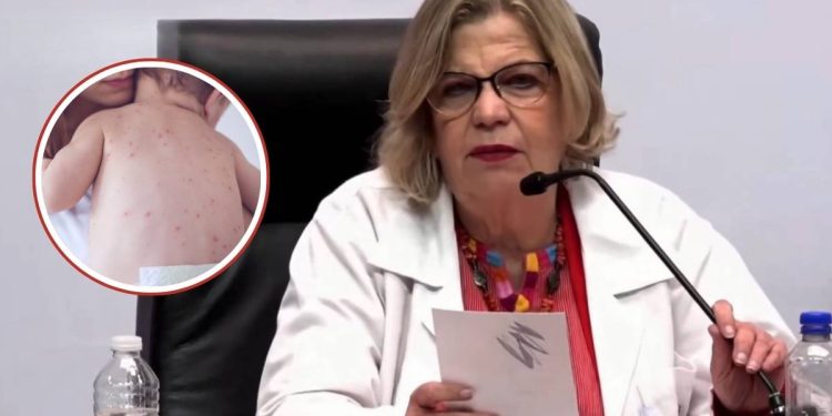 Confirman primera muerte por sarampion en CDMX suman 28 fallecimientos en Mexico