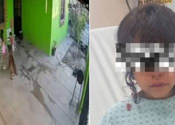 Ataque de pastor belga malinois deja a una niña con 68 puntos en la cabeza en Coahuila