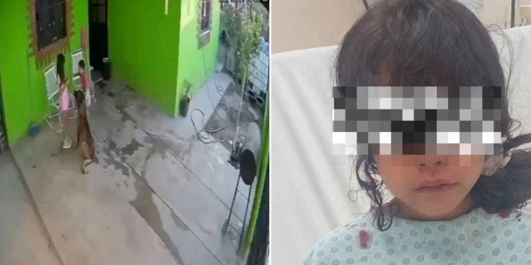 Ataque de pastor belga malinois deja a una niña con 68 puntos en la cabeza en Coahuila