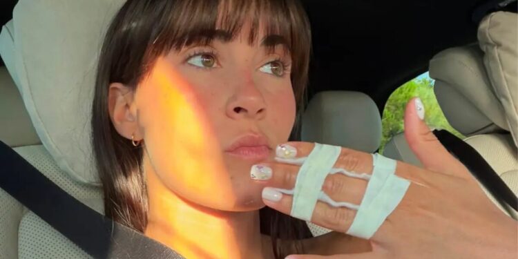 Aitana se rompe un dedo antes de su concierto en Zaragoza