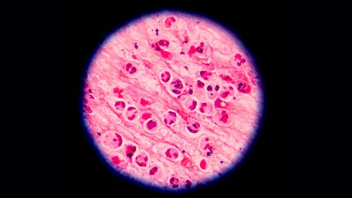 FDA descarto una muestra positiva de Cyclospora