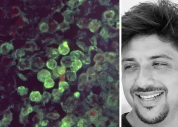 Tragedia en Yucatán: instructor muere por la ameba ‘come cerebros’
